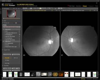 Ophthalmology