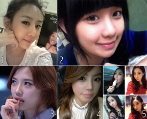 성형외과 전문의 이태희 원장은 “미인의 기준이 점차 이목구비에서 얼굴형으로 변해가는 추세”라며, “이런 이유 때문에 일반인 사이에서도 양악수술이나 안면윤곽 같은 수술이 인기를 얻고 있는 것으로 보인다”고 설명했다.