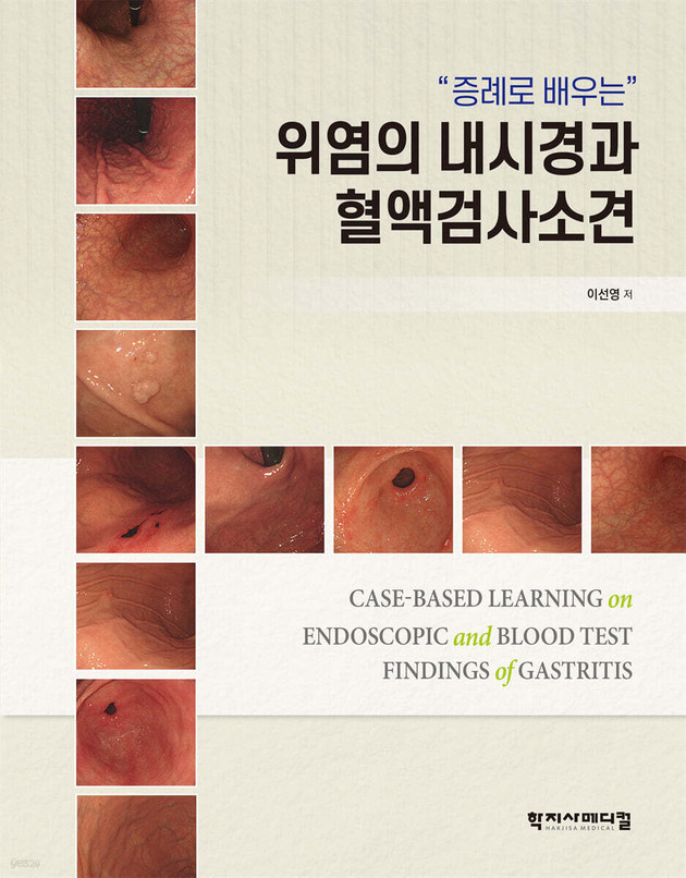 건국대병원 이선영 교수, '위염의 내시경과 혈액검사소견' 출간