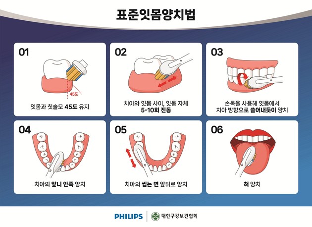 잇몸병, 국내 3대 사망원인 폐렴 위험 높인다