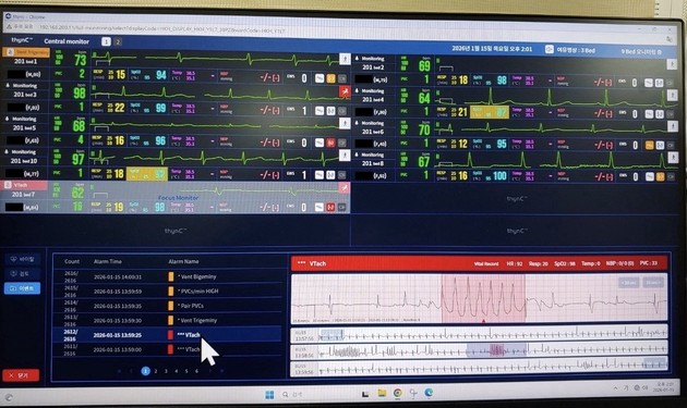 광주한국병원, AI 모니터링 '씽크'로 급성 심정지 환자 살렸다
