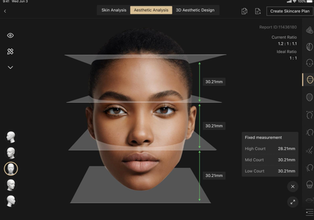 울쎄라·써마지, 시술 전 'AI 메타스캔 피부 분석' 중요
