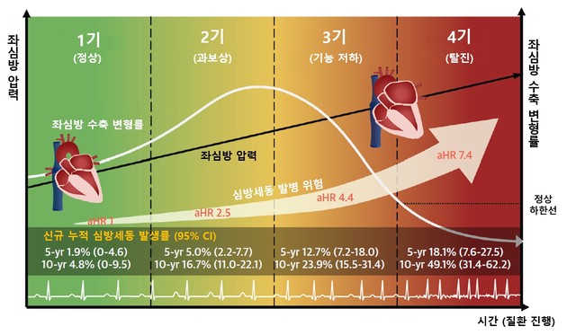 비후성 심근증 심방세동 위험 예측 '좌심방 4단계 병기' 개발